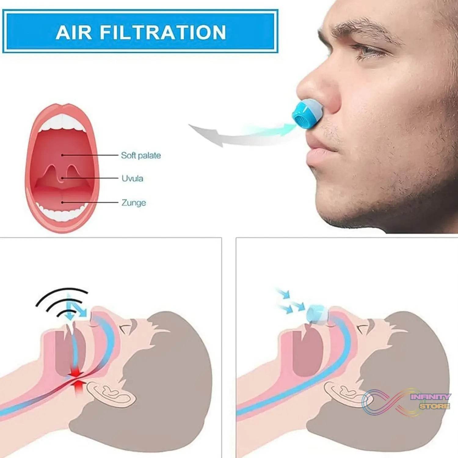 2 in 1 Anti Snoring and Air Purifier Nose Clip Anti Snoring Device (1 Pc / With Plastic Case) - infinityexculsivestore.com
