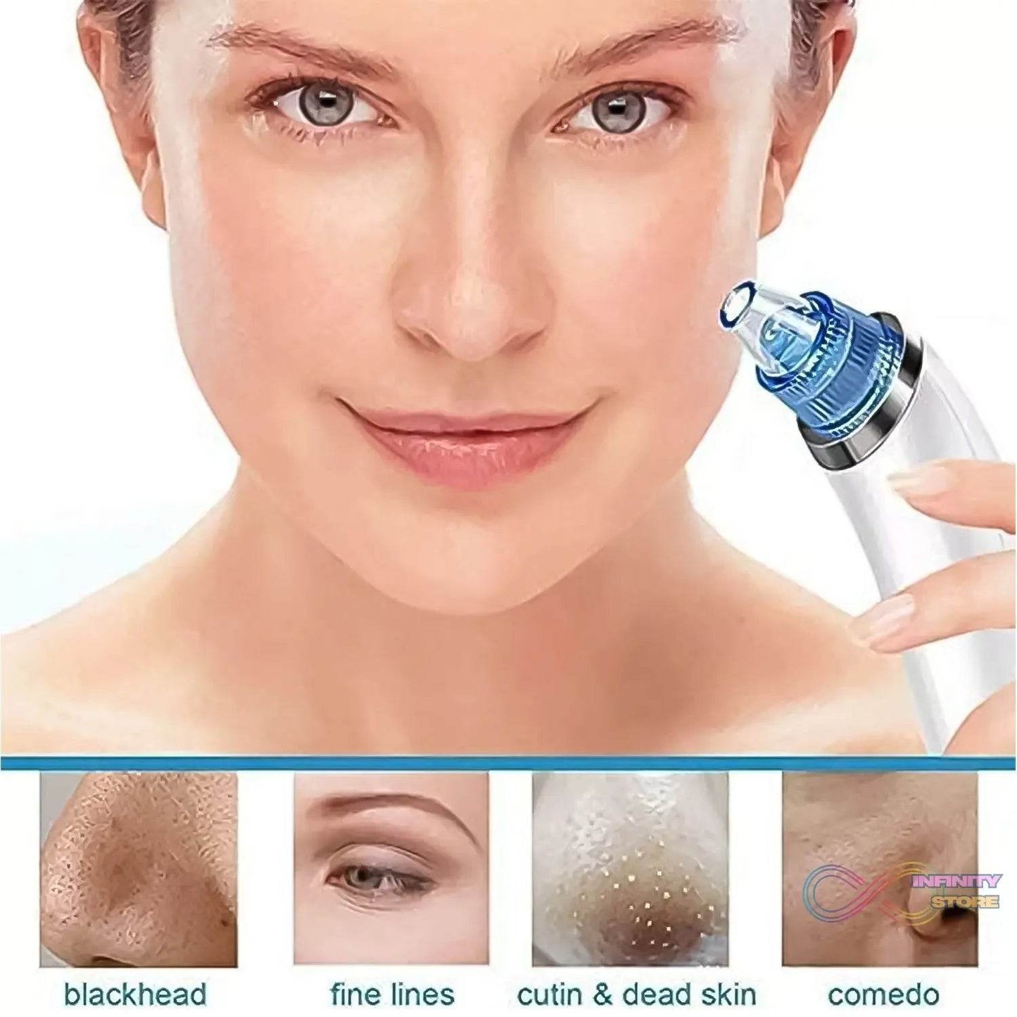 2 in 1 Blackhead Whitehead Extractor Remover Device (Multi - Color / 1 Set / batteries not included) - infinityexculsivestore.com