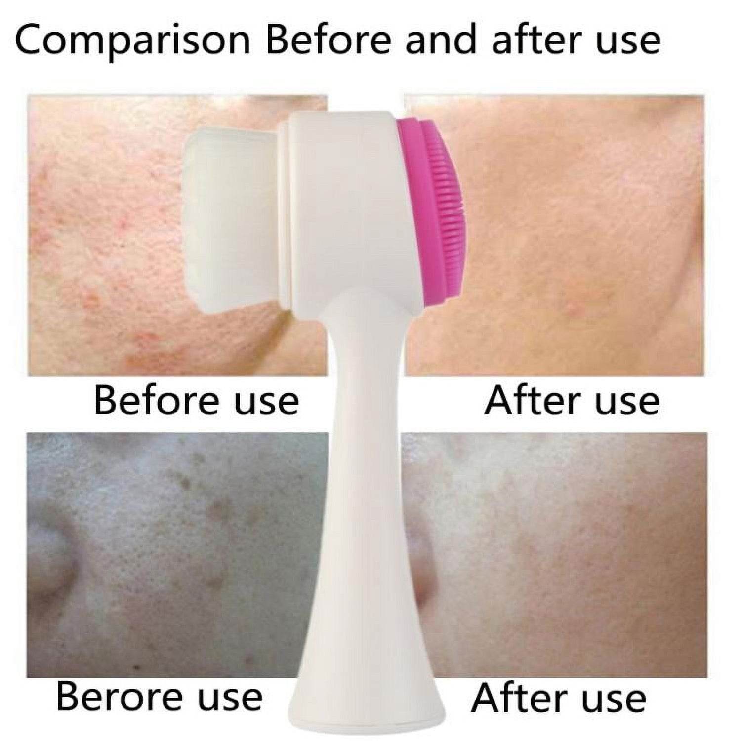 2 in 1 Facial Brush Cleansing | Manual Face Scrubber | Silicone Double - Sided Face Wash Brush for Sensitive, Delicate, Dry Skin (1 Pc) - infinityexculsivestore.com