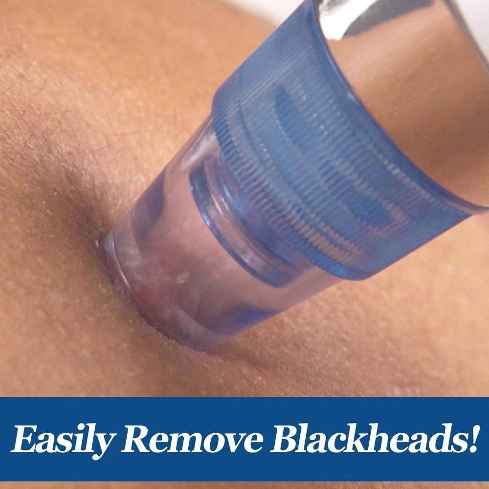 4 In 1 Blackhead Whitehead Extractor Remover Device Acne Pimple Pore Cleaner (Vacuum Suction Tool) - infinityexculsivestore.com