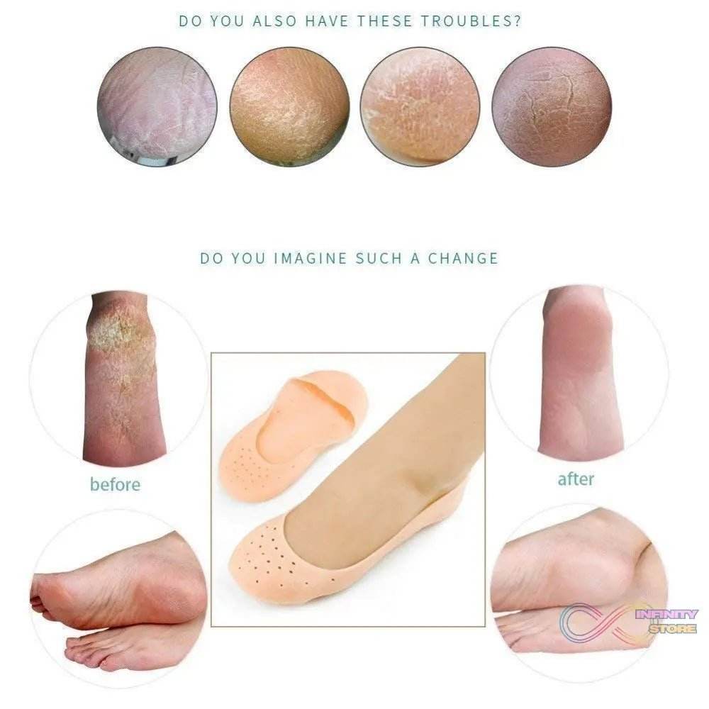 Anti Crack silicone Gel Foot Protector Moisturizing Socks - infinityexculsivestore.com