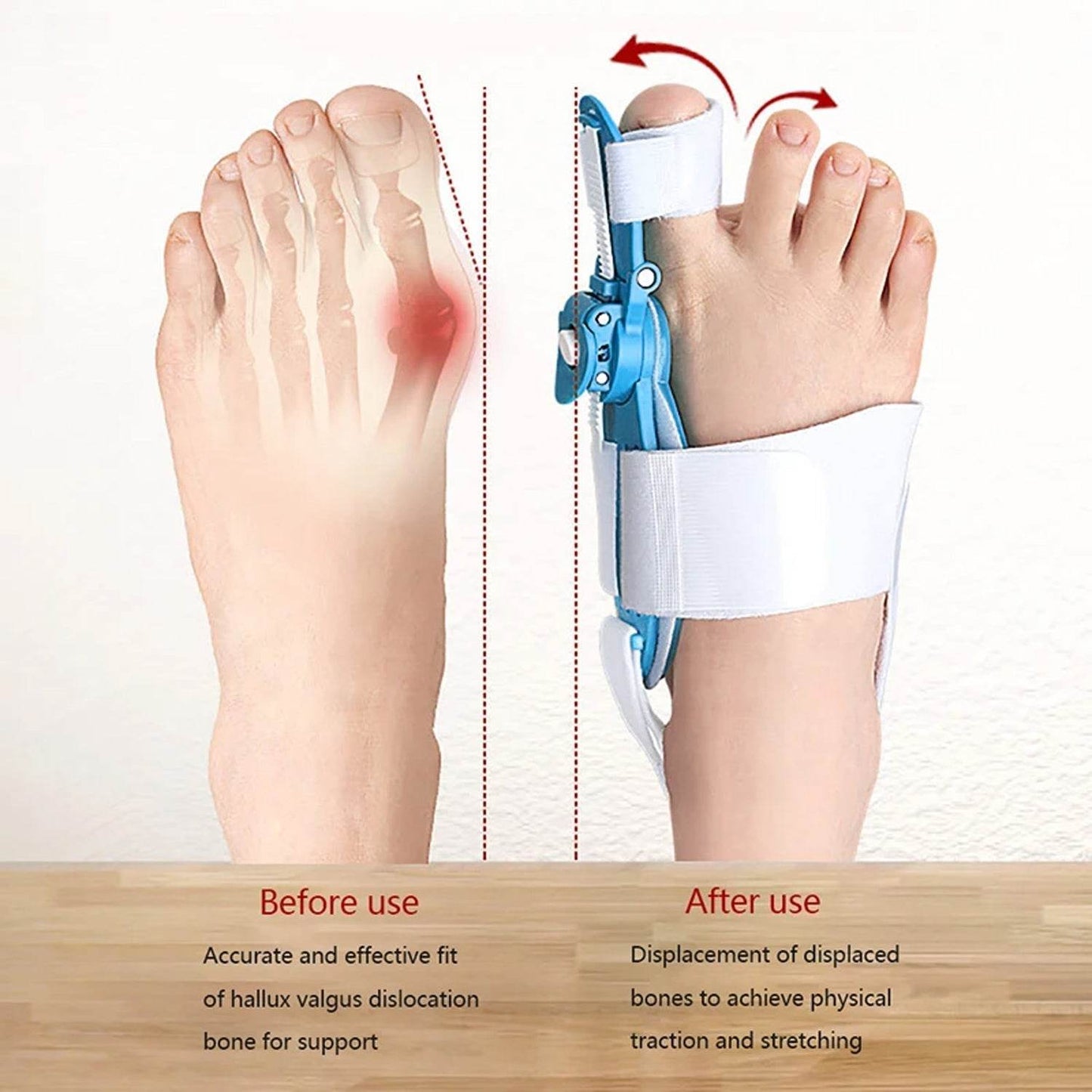 Bunion Support Splint. Valgus And Bunion Valgus, Corrector, Hallux Valgus Corrector, Adjustable Bunion Valgus Protective Cover For Men And Women - infinityexculsivestore.com