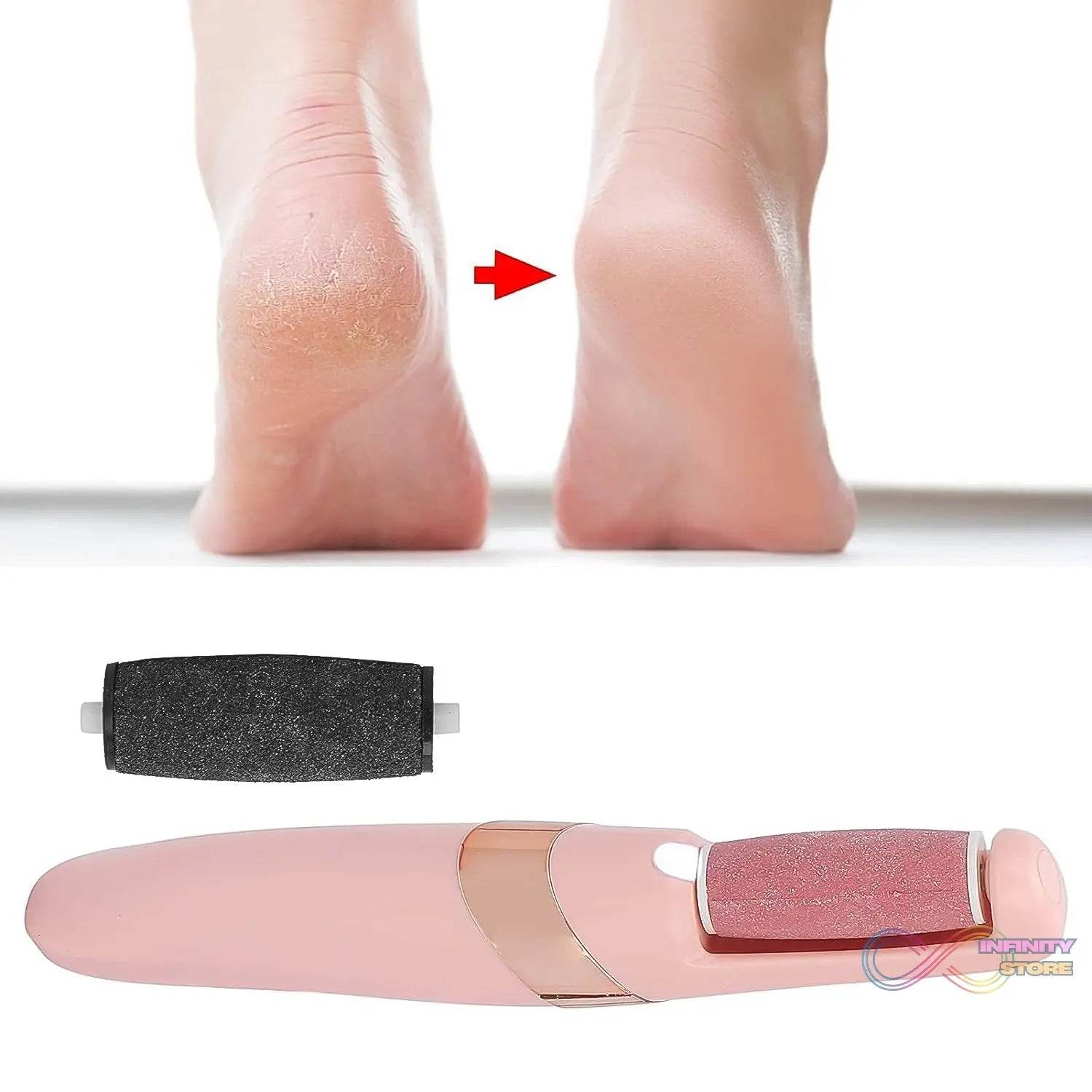 Flewless Pedi Electronic Pedicure Tool (1 Set) - infinityexculsivestore.com