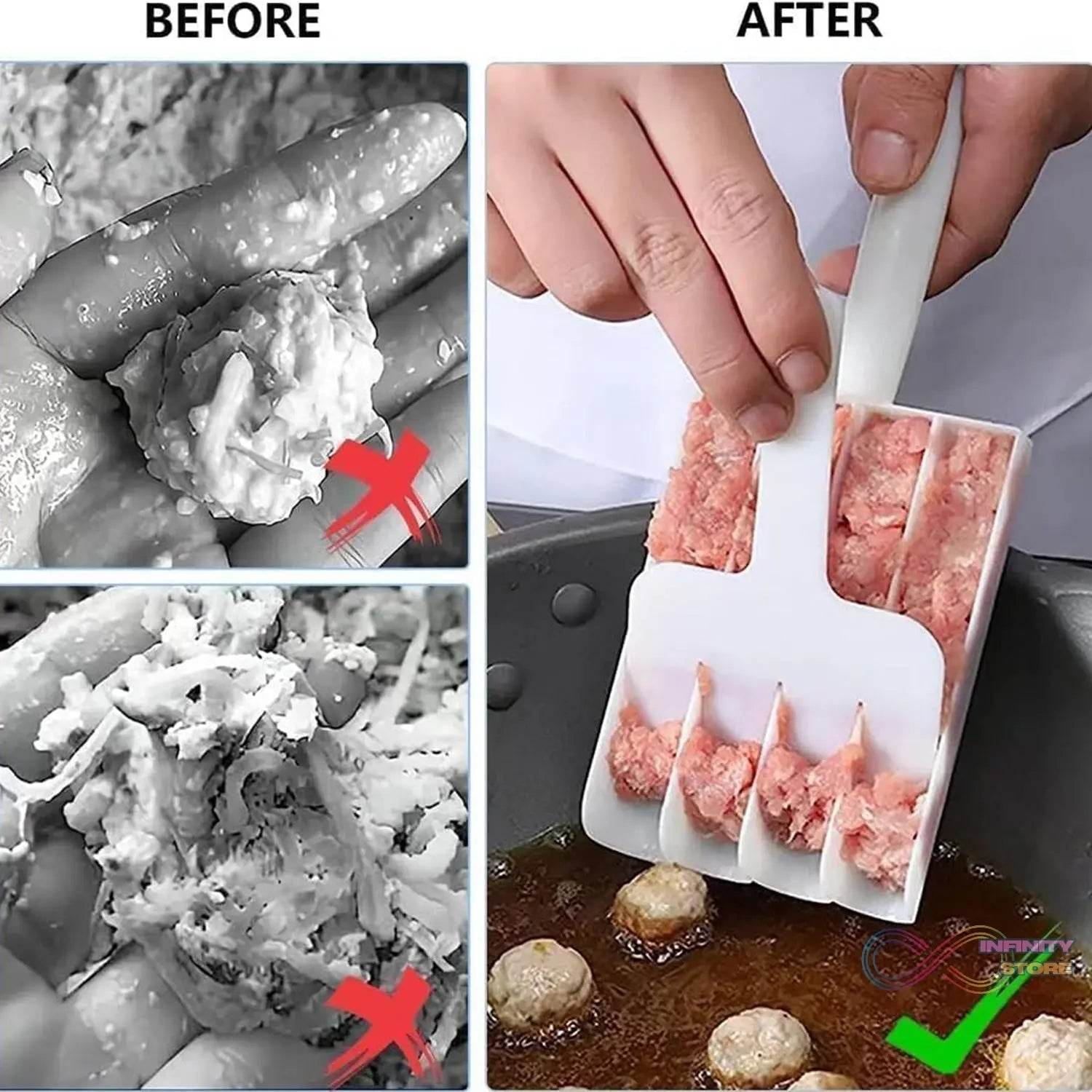 Gujia & Meatball Maker Set Easily Shape Meatballs Maker (1Pc) - infinityexculsivestore.com