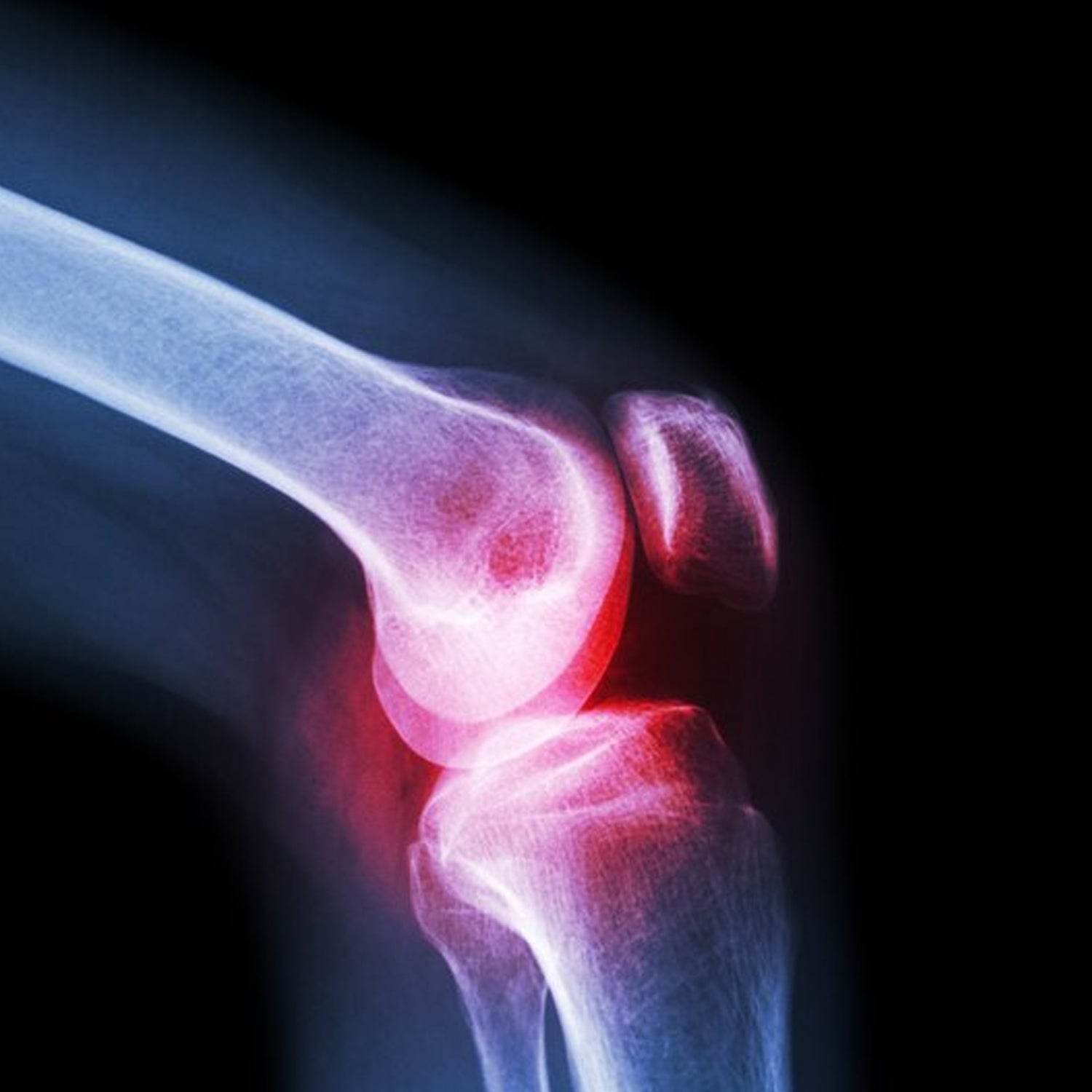 Knee Cap for Knee Support (Large) - infinityexculsivestore.com