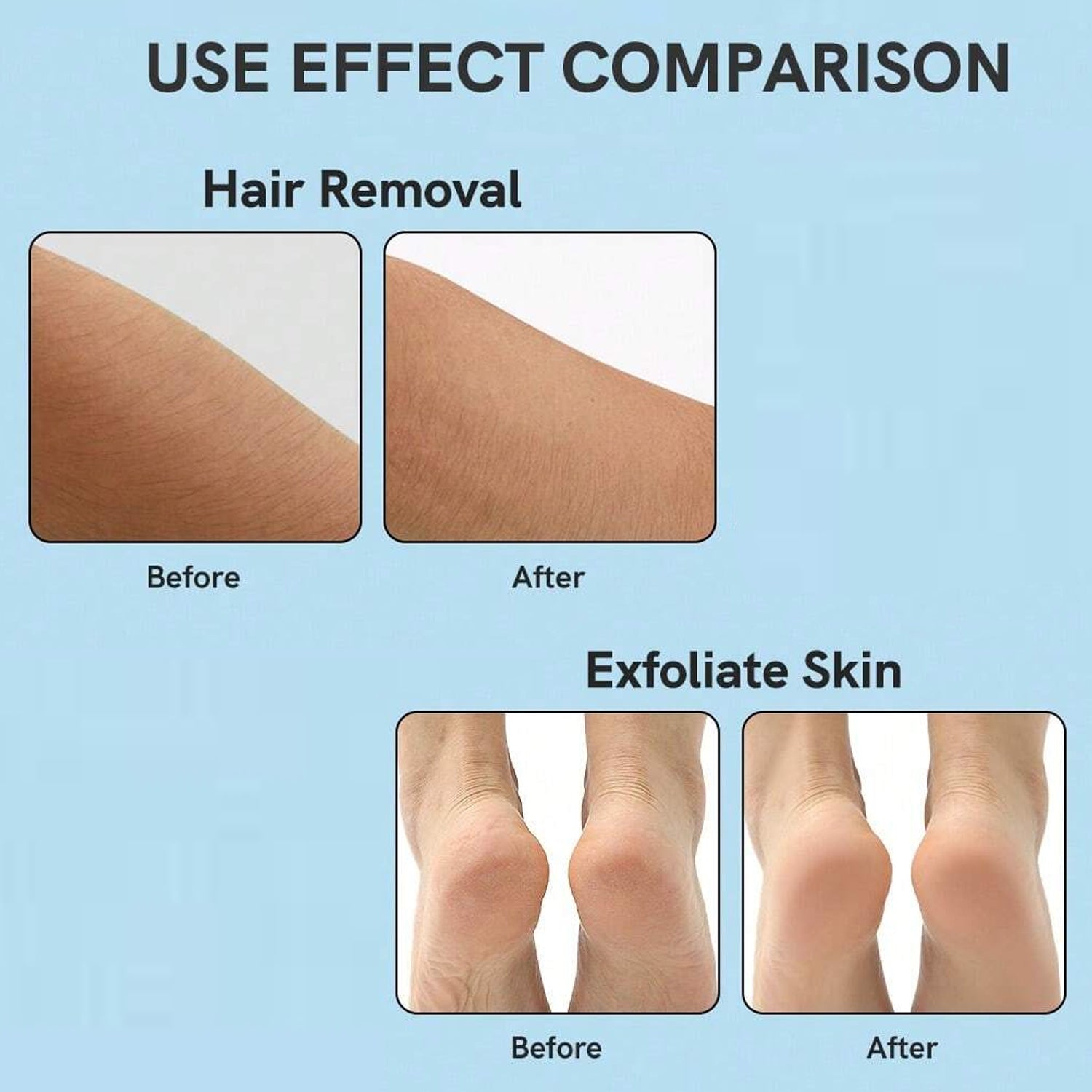 Nano Hair Remover for Arms, Legs, Back One Sided Skin Hair Remover (1 Pc) - infinityexculsivestore.com
