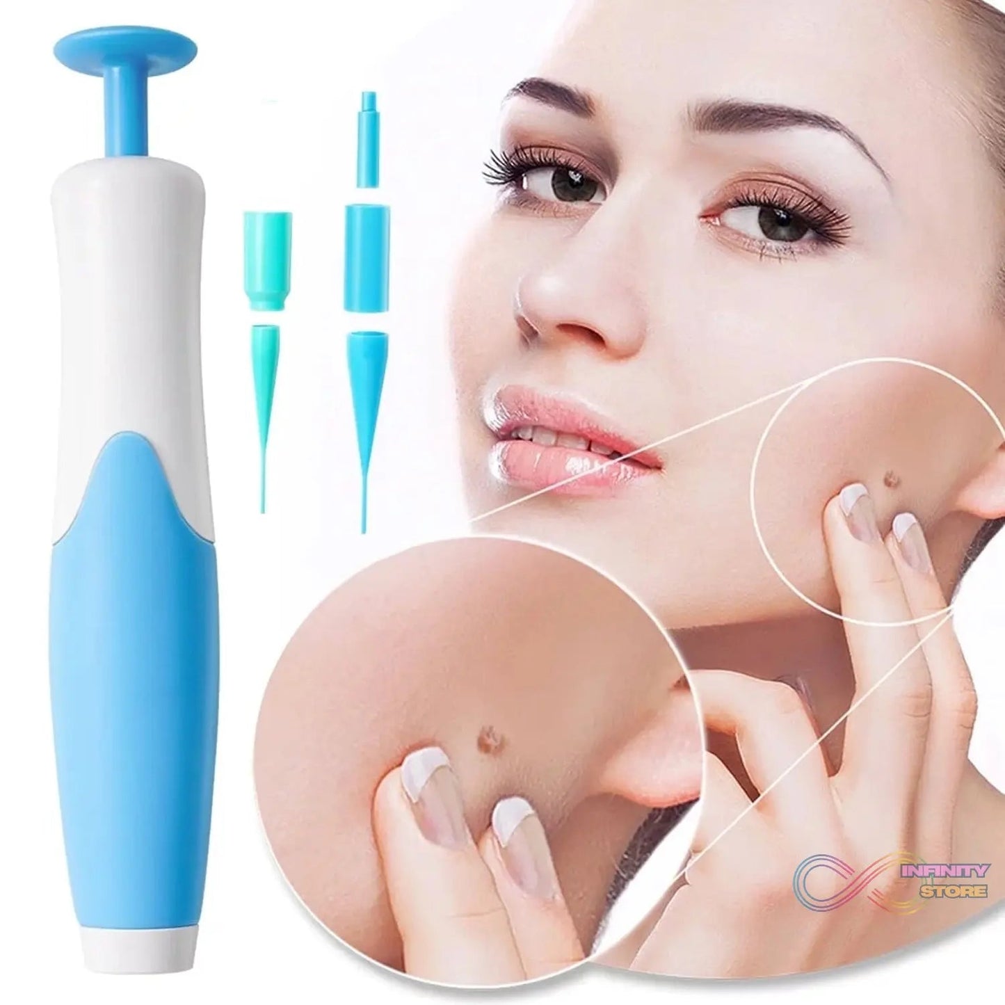 Skin Tag Remover Kit 2 in 1 for Micro to Large (2 mm - 8 mm / 1 Set) - infinityexculsivestore.com