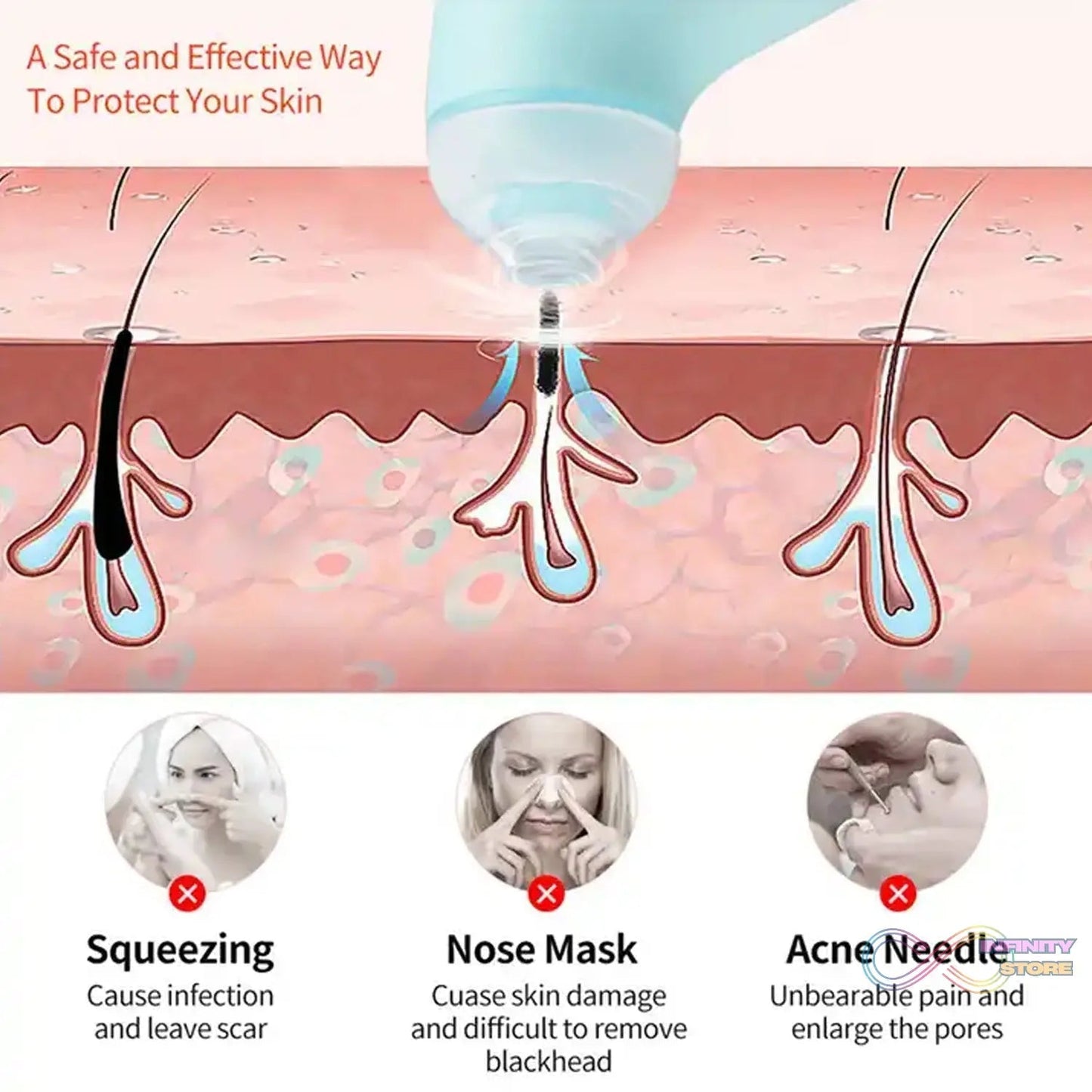 Vacuum Blackhead Machine, Reduce Spot Mini Handheld Lifting Massage Facial Blackhead Remover For Skin Care (1 Pc) - infinityexculsivestore.com