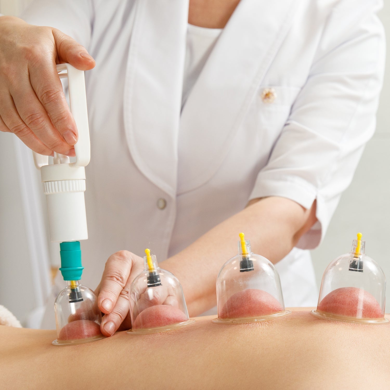 Vacuum Cupping Set 6 Pcs Kit Pull Out a Vacuum Apparatus Therapy Relax Massagers Curve Suction Pumps - infinityexculsivestore.com