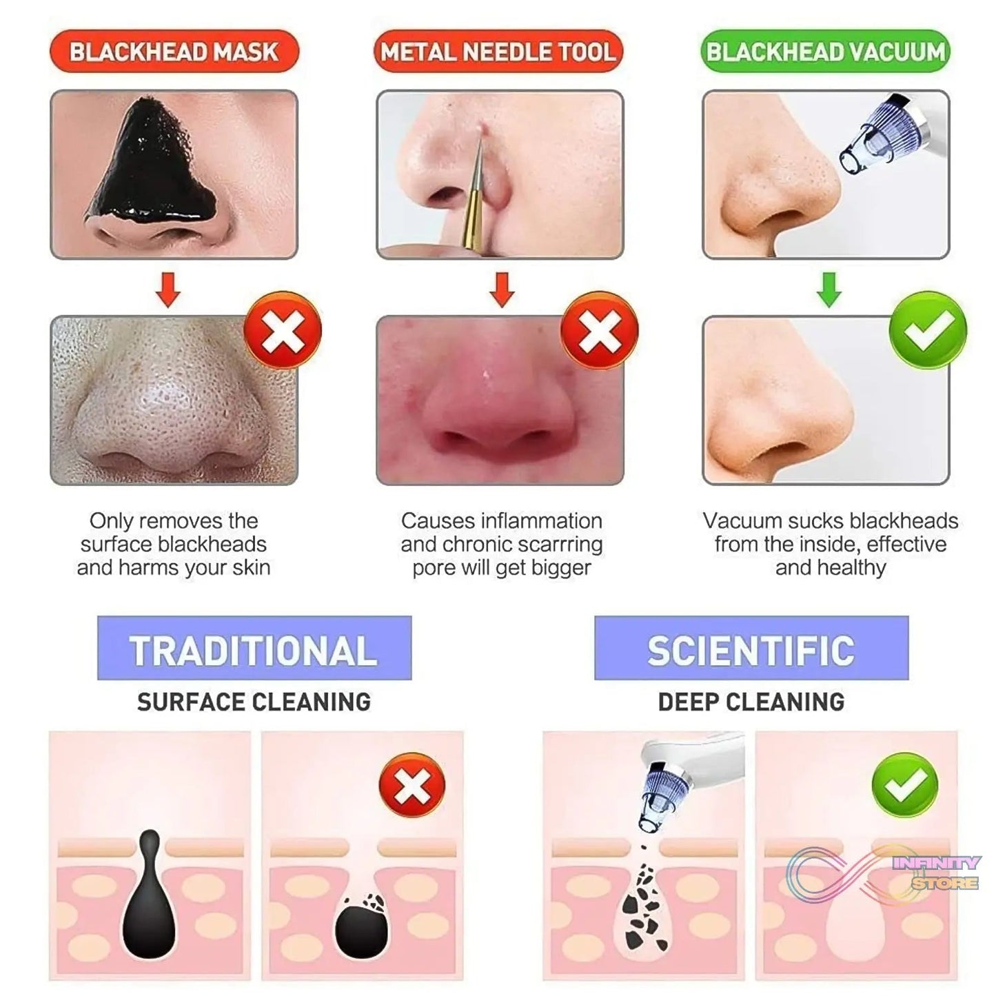 Vacuum Suction Tool with 4 Suction Head for Men and Women (Multi - Color / 1 Set) (batteries not included) - infinityexculsivestore.com