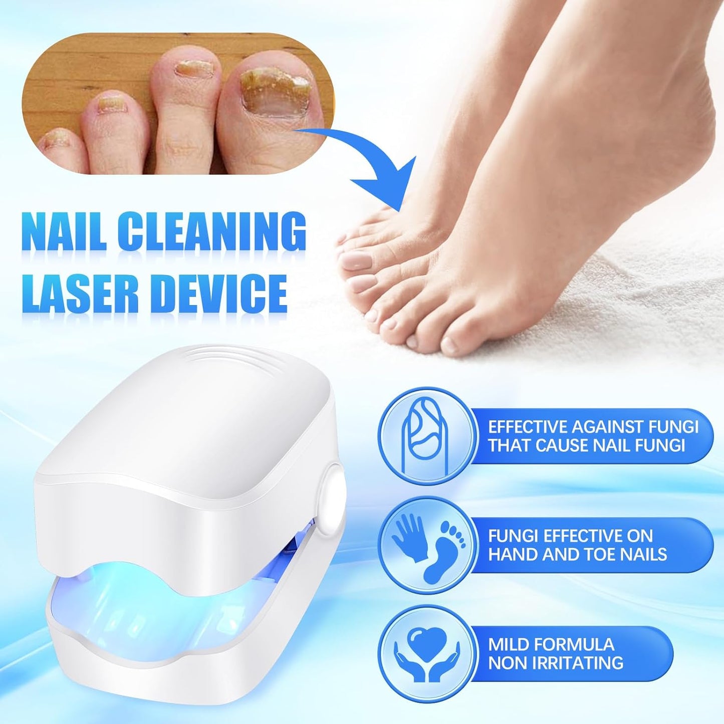 Rechargeable Nail Fungus Treatment for Toenail, Toe Nail Fungal Treatment Nail Fungus Laser Device, Anti - Fungal Nail Treatment for Hand & Feet Infections Remover for Home Use - infinityexculsivestore.com