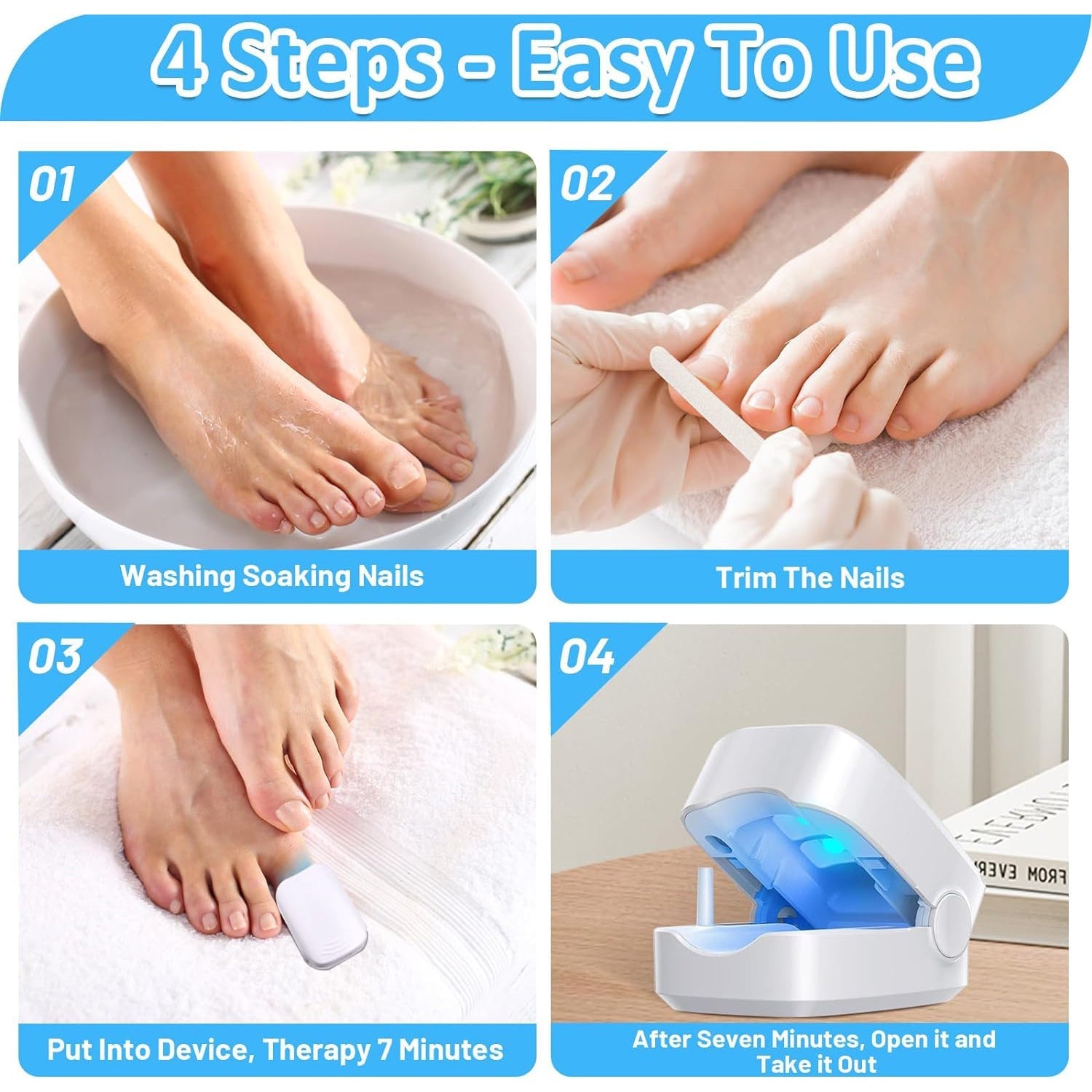 Rechargeable Nail Fungus Treatment for Toenail, Toe Nail Fungal Treatment Nail Fungus Laser Device, Anti - Fungal Nail Treatment for Hand & Feet Infections Remover for Home Use - infinityexculsivestore.com