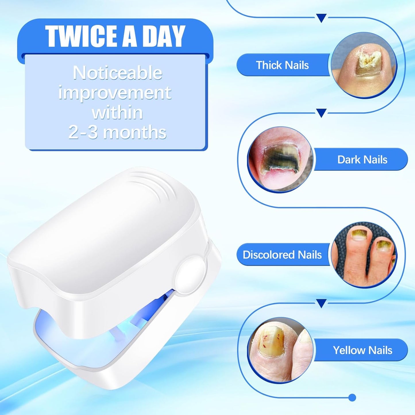 Rechargeable Nail Fungus Treatment for Toenail, Toe Nail Fungal Treatment Nail Fungus Laser Device, Anti - Fungal Nail Treatment for Hand & Feet Infections Remover for Home Use - infinityexculsivestore.com