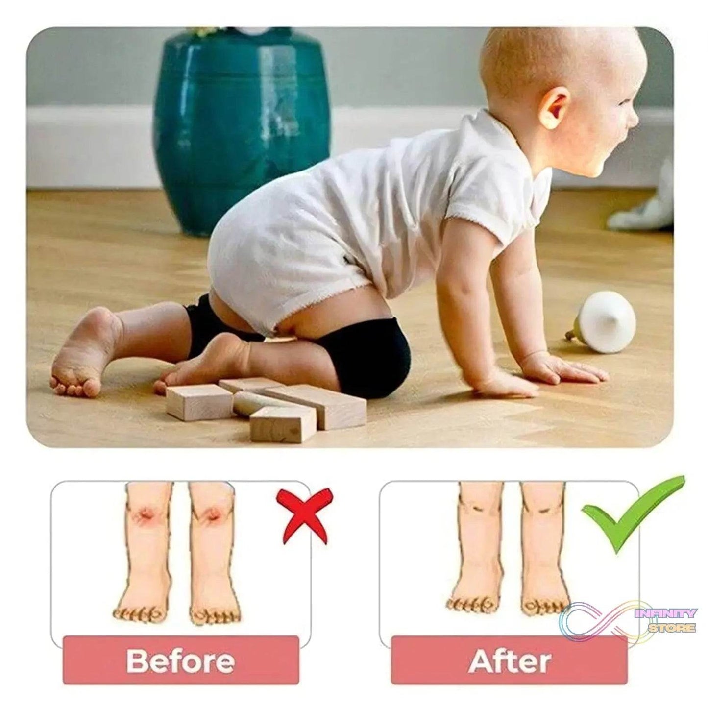 1 Pairs Baby Knee Pads for Crawling (1 Pair / 6 Cm) - infinityexculsivestore.com