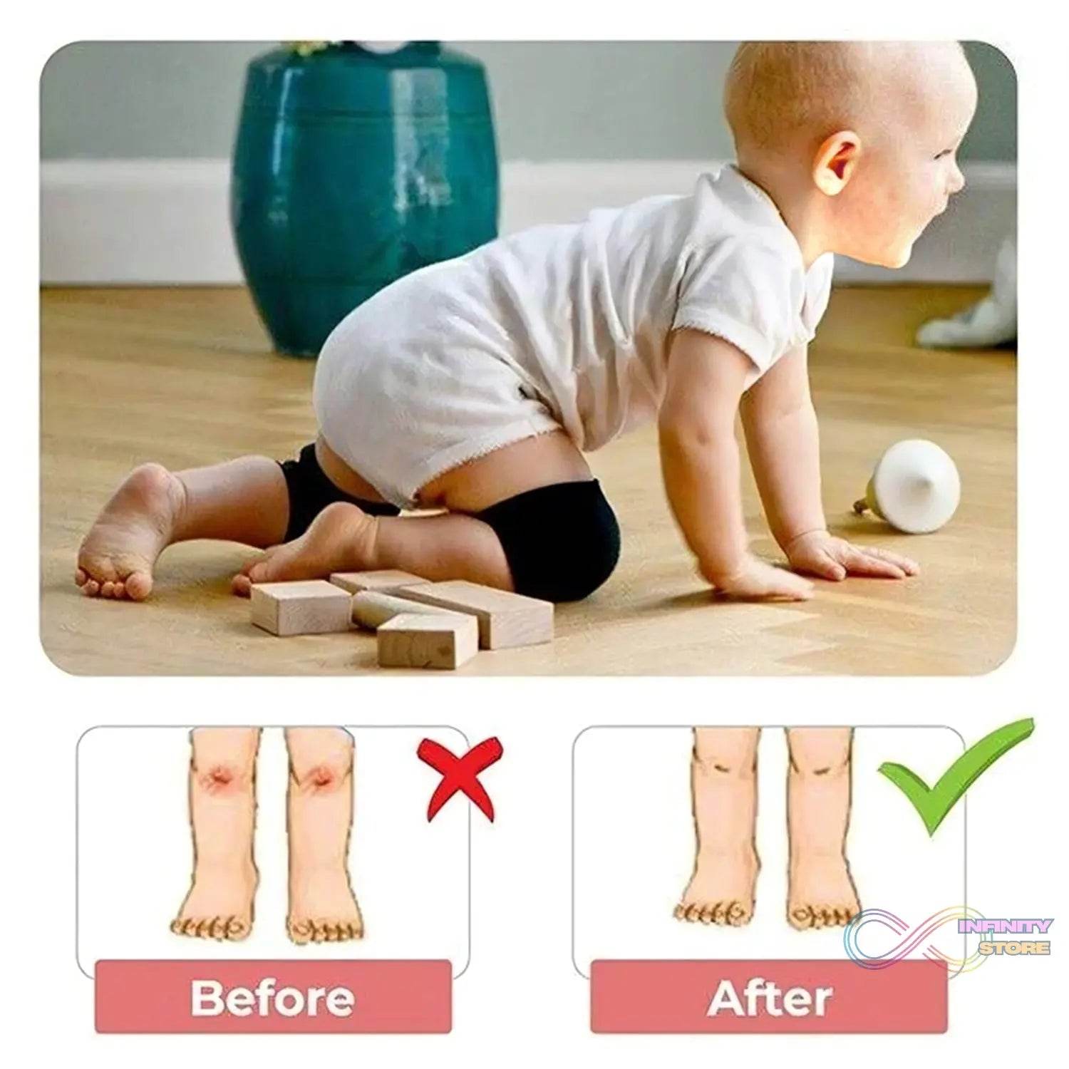 1 Pairs Baby Knee Pads for Crawling (1 Pair / 6 Cm) - infinityexculsivestore.com