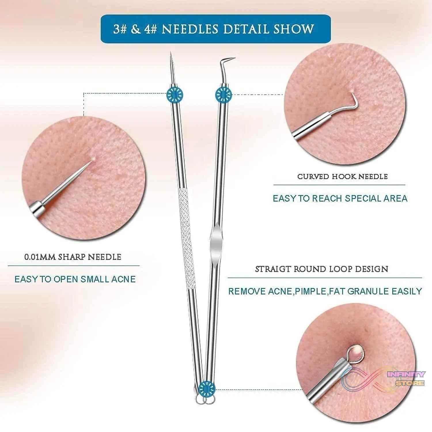 Blackhead Remover, 4-in-1 Stainless Steel Pimple Extractor Tool (1 Pc) - infinityexculsivestore.com