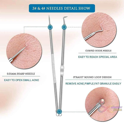 Blackhead Remover, 4-in-1 Stainless Steel Pimple Extractor Tool (1 Pc) - infinityexculsivestore.com