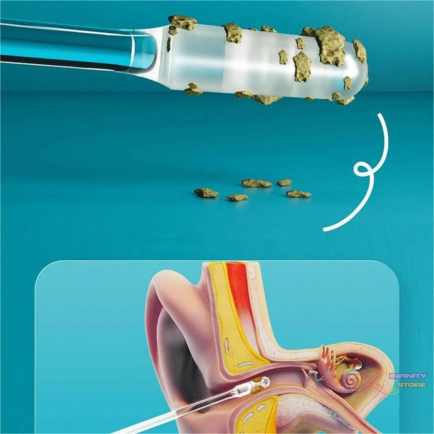 Ear wax Cleaner Stick Silicone Reusable Sticky Ear wax Removal Kit (12 Pcs Set) - infinityexculsivestore.com