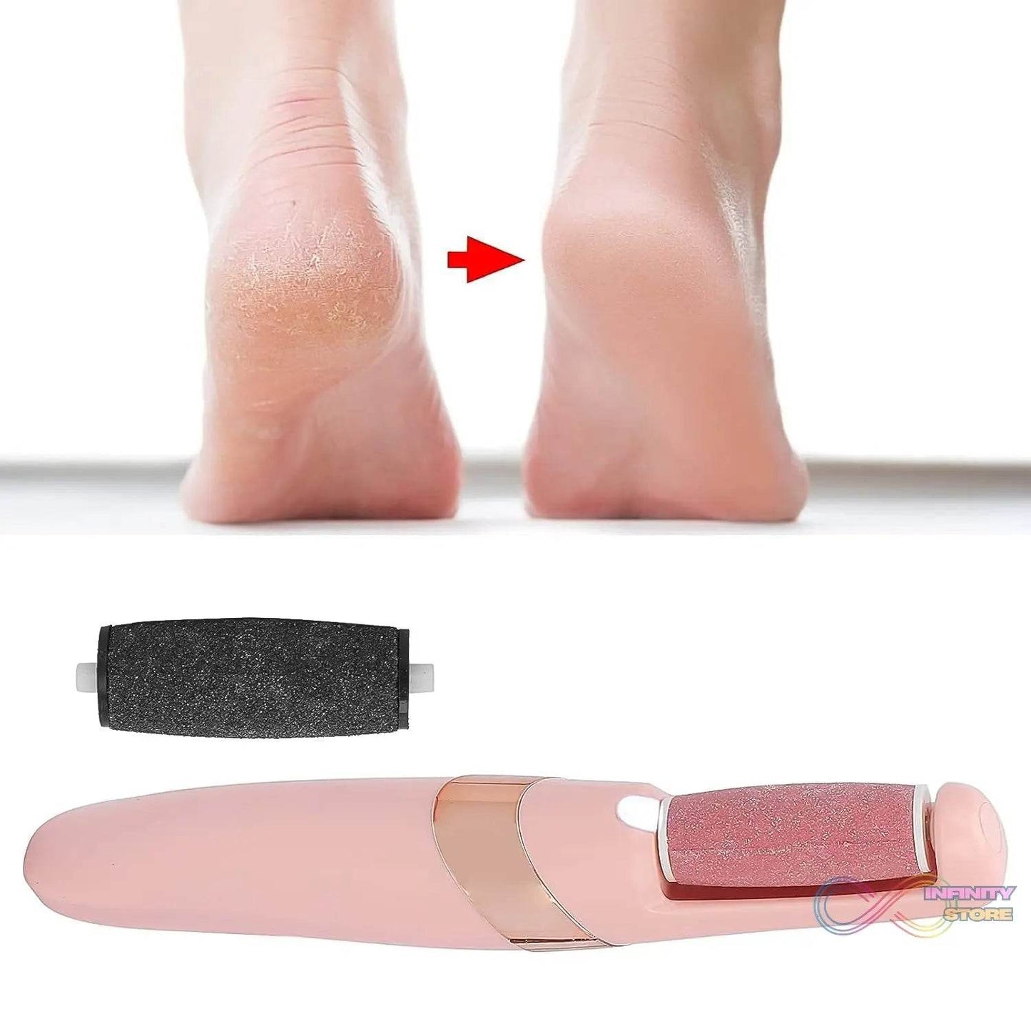 Flewless Pedi Electronic Pedicure Tool (1 Set) - infinityexculsivestore.com