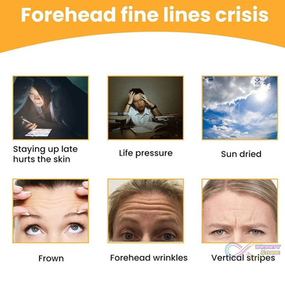 Forehead Wrinkle Patches, Face Wrinkle Patches (10 Pcs Set) - infinityexculsivestore.com