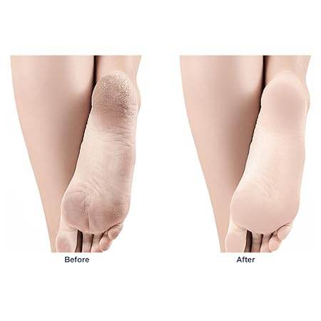 Grinding Feet Artifact Exfoliating Nano glass Grinding Stone House Frustrated Feet Foot Scraping Heel - infinityexculsivestore.com