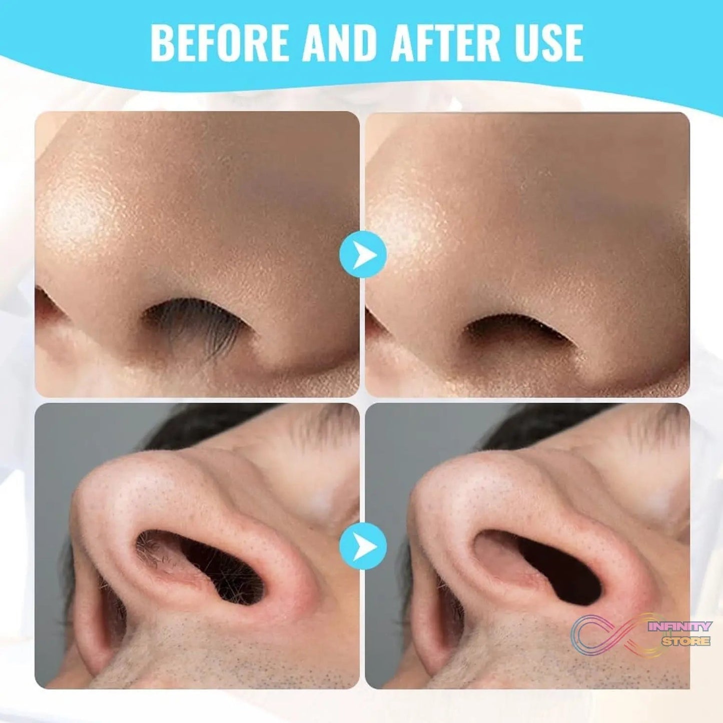 Nose Hair Removal Trimmer Nose Hair Remover Razor Kit Blade (3 Pcs Set) - infinityexculsivestore.com