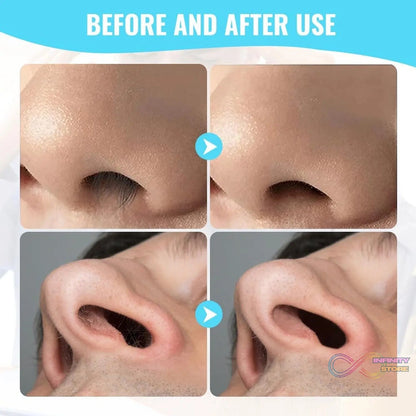 Nose Hair Removal Trimmer Nose Hair Remover Razor Kit Blade (3 Pcs Set) - infinityexculsivestore.com