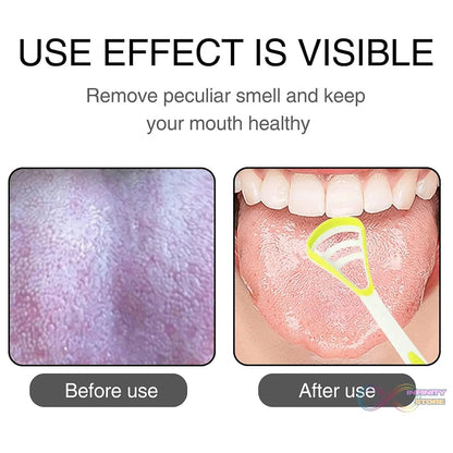 Oral Tongue Cleaner Brush Scraper Health Personal Care Dental Care Tongue Cleaner (1 Pc / Multicolor) - infinityexculsivestore.com