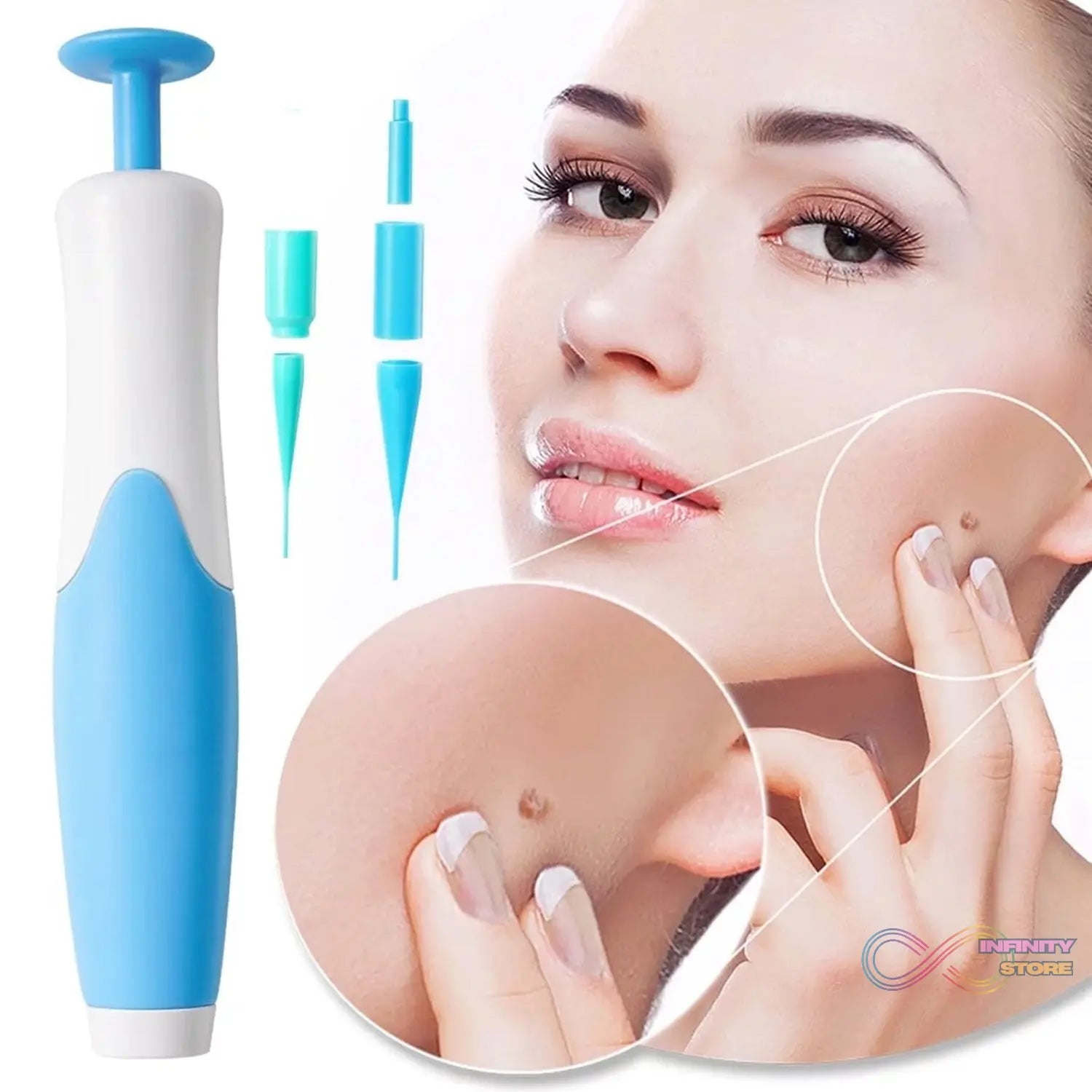 Skin Tag Remover Kit 2 in 1 for Micro to Large (2 mm - 8 mm / 1 Set) - infinityexculsivestore.com