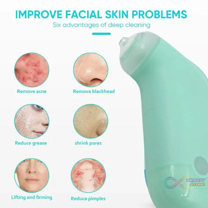 Vacuum Blackhead Machine, Reduce Spot Mini Handheld Lifting Massage Facial Blackhead Remover For Skin Care (1 Pc) - infinityexculsivestore.com