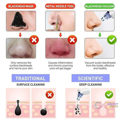 Vacuum Suction Tool with 4 Suction Head for Men and Women (Multi - Color / 1 Set) (batteries not included) - infinityexculsivestore.com