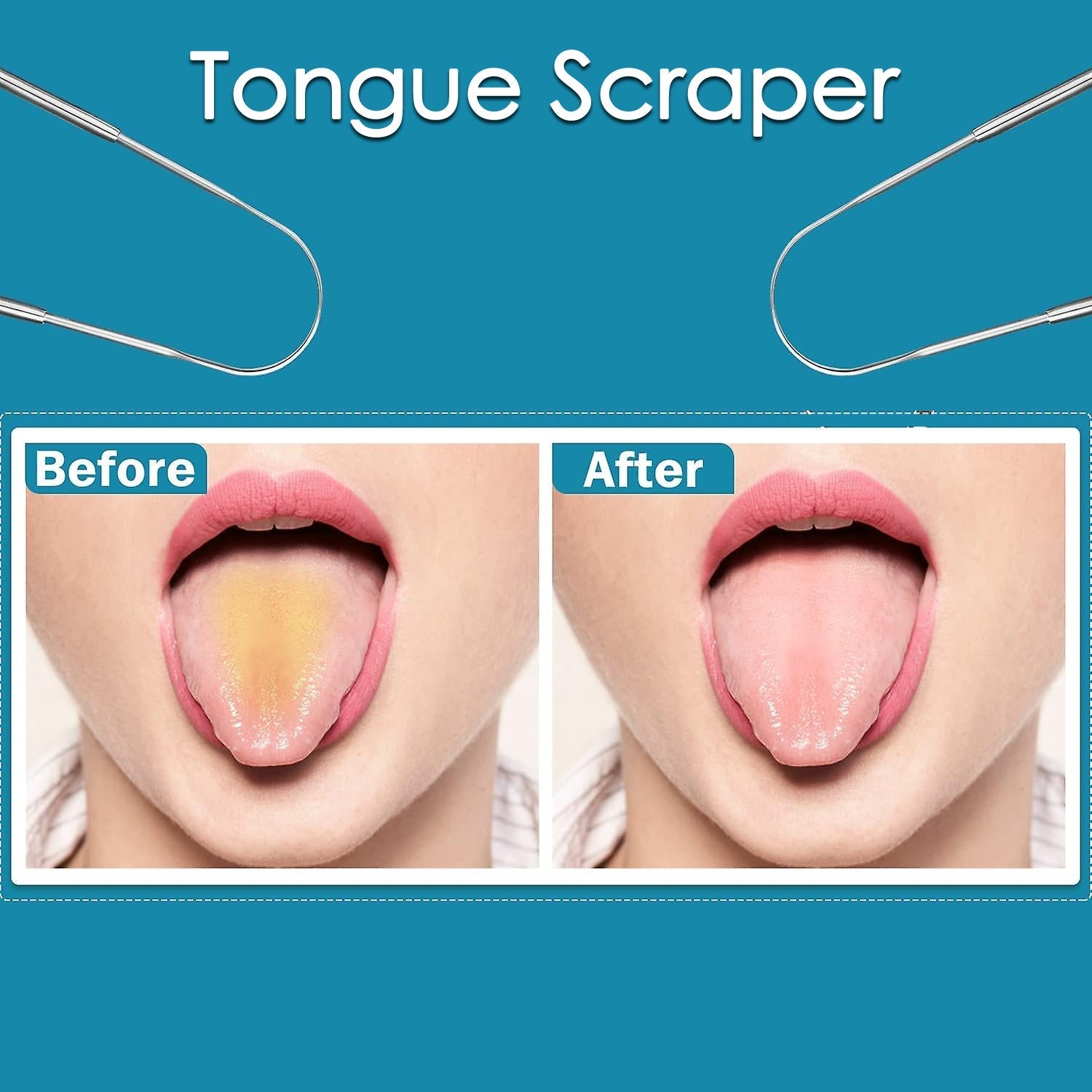 Tongue Cleaner For Kids & Adults | Tongue Scraper For Bad Breath, Maintain Oral Hygiene for Daily Use | for Fresh Breath & Bacteria Removal | Improved Taste (Steel, Copper, Tongue Cleaner / 1 Pc) - infinityexculsivestore.com