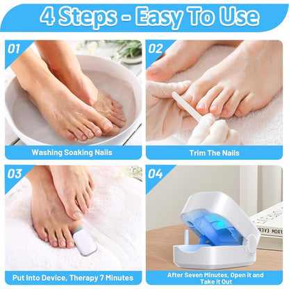 Rechargeable Nail Fungus Treatment for Toenail, Toe Nail Fungal Treatment Nail Fungus Laser Device, Anti - Fungal Nail Treatment for Hand & Feet Infections Remover for Home Use - infinityexculsivestore.com